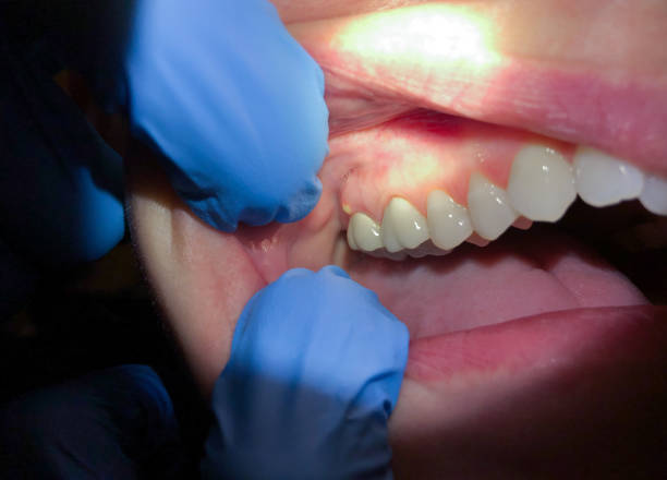 Best Mobile Emergency Dentist in Volcano Golf Course, HI