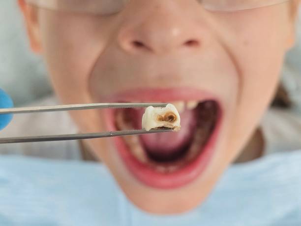 Best Pediatric Emergency Dentist in Volcano Golf Course, HI